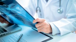 This is how lung cancer is not treated in Poland yet.  The temperature was -120 degrees Celsius!