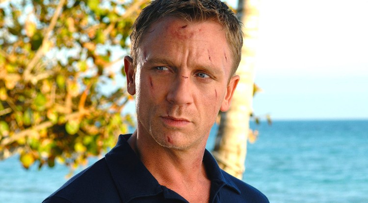 Daniel Craig ismét balesetet szenvedett egy forgatáson.