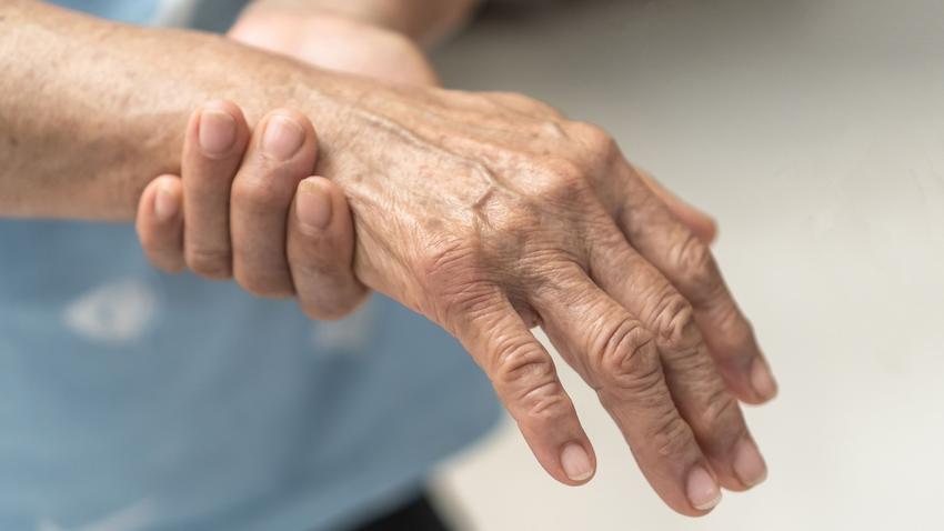 Reggeli kézmerevség duzzanat ízületi gyulladás tünetei artritisz