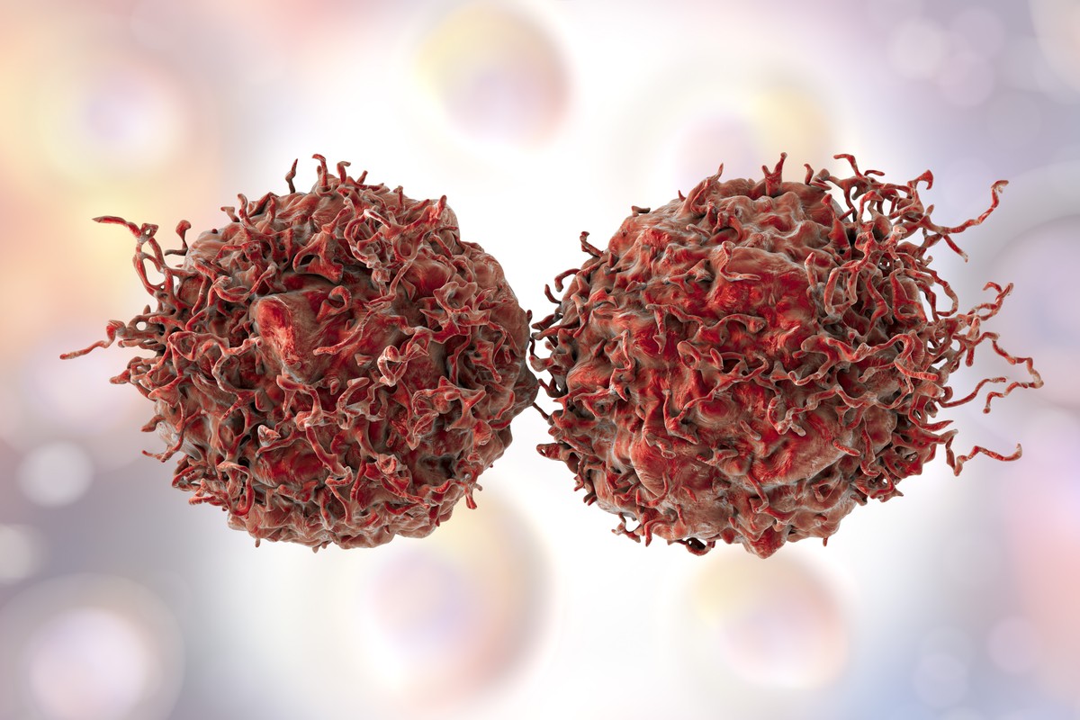 Komórki rakowe kurczyły się przez odpowiedź immunologiczną na COVID
