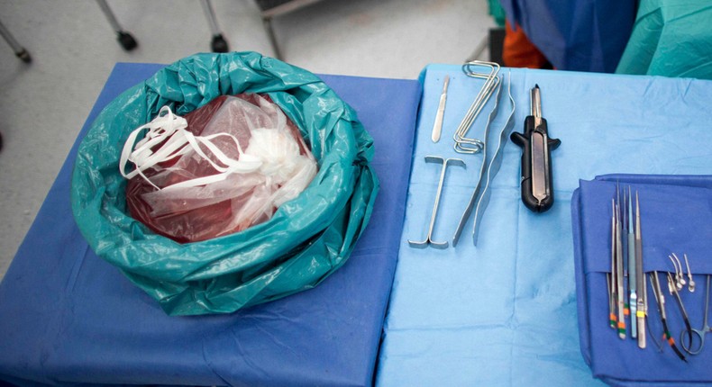 A piece of healthy liver that was removed from a person rests in a bag before being transplanted.