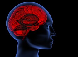 Jak rozpoznać udar mózgu?