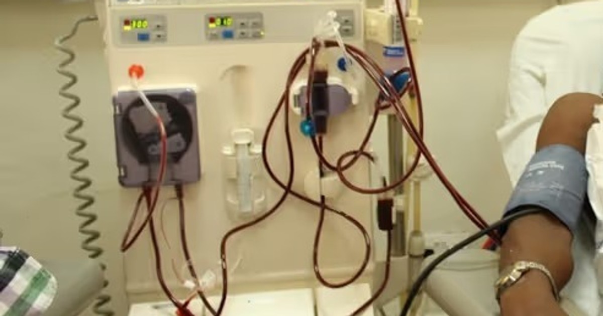 Bawumia announces free kidney dialysis for all NHIS patients starting Dec 1