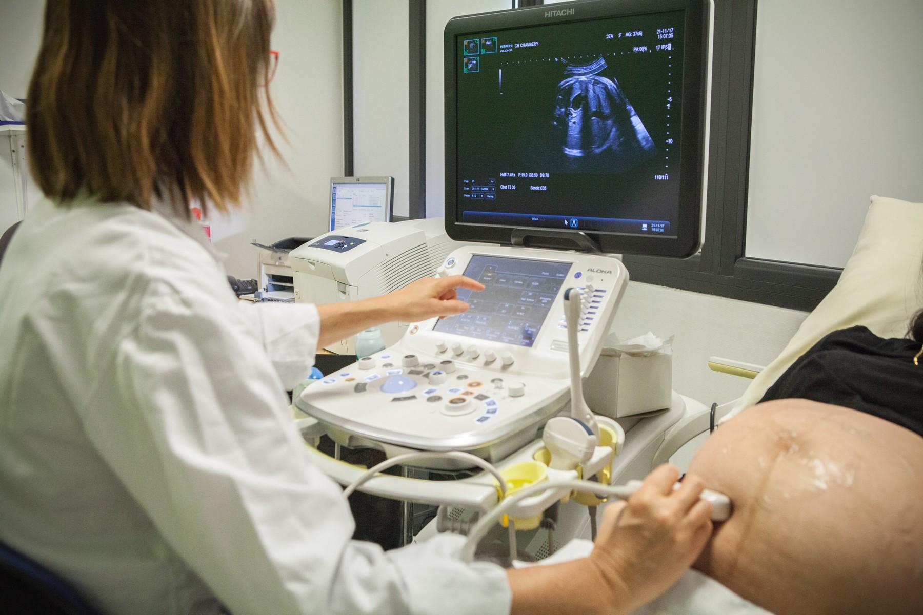 2D, 3D, 4D, prenatálny či genetický? O čom je ktorý ultrazvuk v tehotenstve  | Najmama.sk