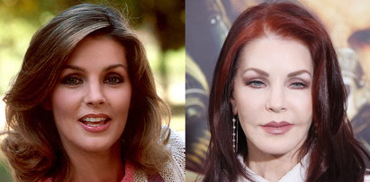 Tak zmieniła się twarz Priscilli Presley. Będziesz w szoku!