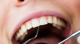 Zęby będą się regenerować? Ten wynalazek może być przełomem w stomatologii