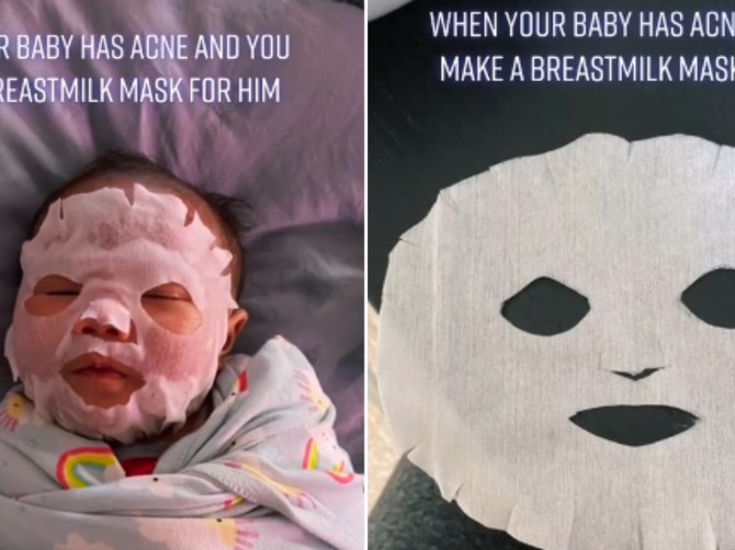 Mama stavlja na lice bebi maske od svog mleka