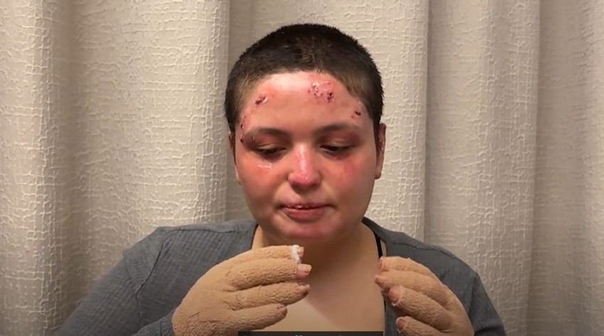 Roze, žrtva požara u Kran Montani