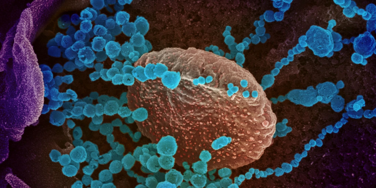 Koronawirus widziany w mikroskopie elektronowym – to te niebieskie okrągłe obiekty na powierzchni komórek hodowanych w laboratorium. 