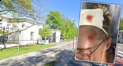 Poturbowana trafiła do szpitala. Pokazała straszne obrażenia. "Mam nadzieję, że uda się dorwać tego szkodnika"