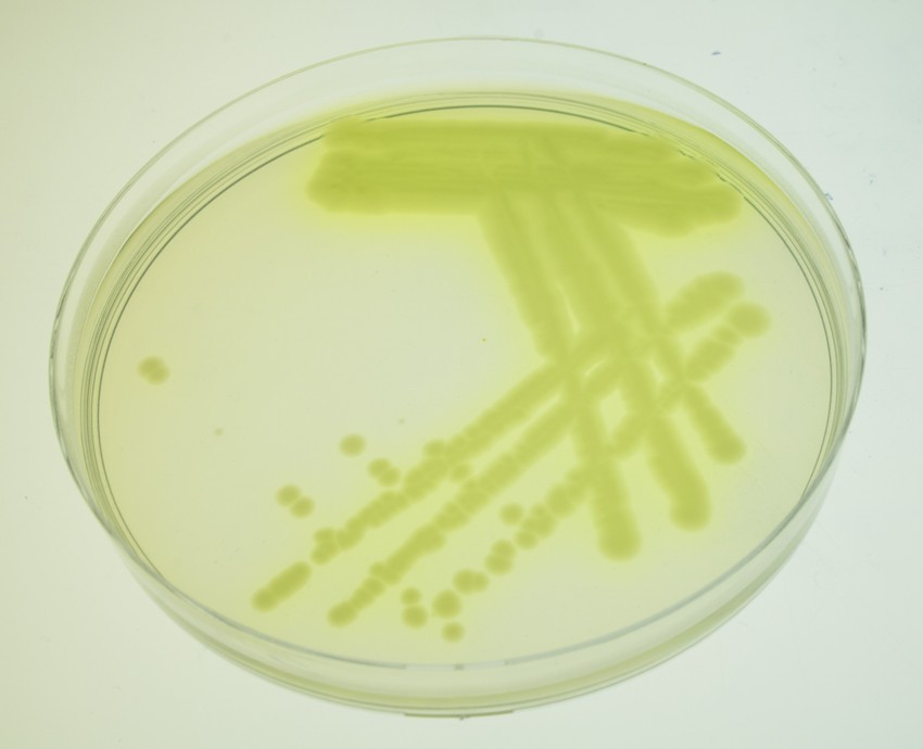 Bakterija Pseudomonas aeruginosa je veoma otporna na bakterije