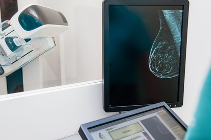 Mellrák: az új rendszer évekkel korábban diagnosztizálhatja a daganatot
