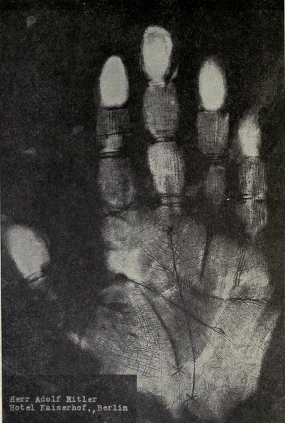 Pogled na šaku Adolfa Hitlera hiromantu Džozefu Ranaldu bio je dovoljan da predvidi sudbinu jednog od najvećih zločinaca na svetu (FOTO: How to know people by their hands/Josef Ranald)