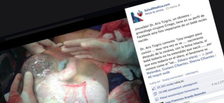 Niewiarygodne! To dziecko urodziło się w worku