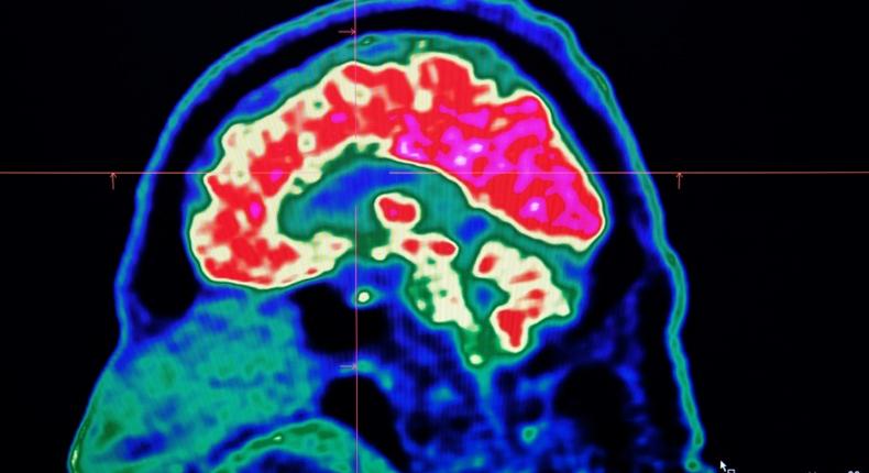 A new study honed in on the brain circuitry responsible for upgrading or downgrading pain signals, likening the mechanism to how a home thermostat controls room temperature