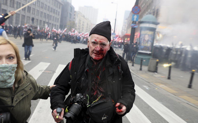 Marsz Niepodległości. Legendarny fotoreporter postrzelony w twarz