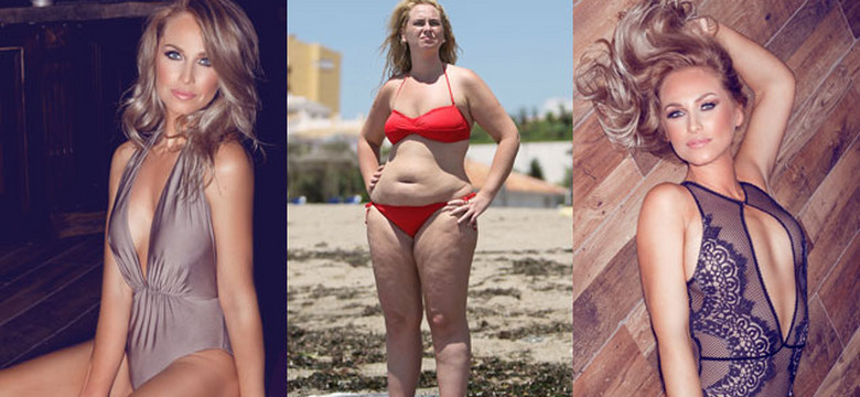Miała nadwagę i cellulit. Schudła 44 kilogramy! Aż trudno uwierzyć jak teraz wygląda