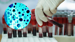 Prosty test krwi może wykryć 50 rodzajów raka, zanim ten da objawy. Szykuje się rewolucja