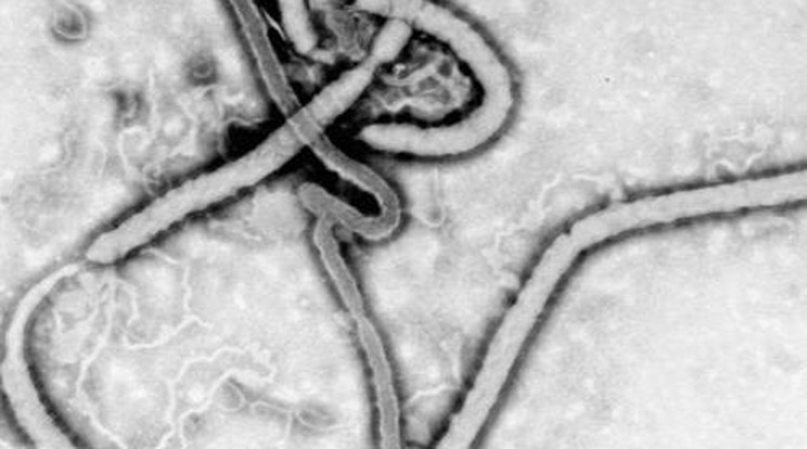 Megvan az ebola elleni vakcina? Bevált a majmokon az új hatóanyag