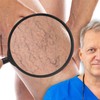 Ljudi očekuju da prvo vide velike plave vene, međutim, često sve počinje mnogo diskretnije, objašnjava vaskularni hirurg dr Dario Jocić