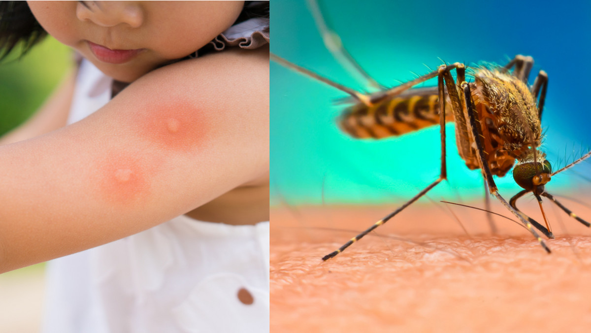 Często gryzą cię komary? To lato może być dla ciebie szczególnie uciążliwe. Duża liczba insektów to skutek obfitych opadów i wysokiej temperatury. Jeśli nie możesz opędzić się od tnących ciało owadów, zapewne zainteresuje cię trik, który Meksykanie stosują od lat. Wypróbowała go australijska dziennikarka, Vanessa Brown. Jak twierdzi - dzięki niemu komary zniknęły bez śladu.