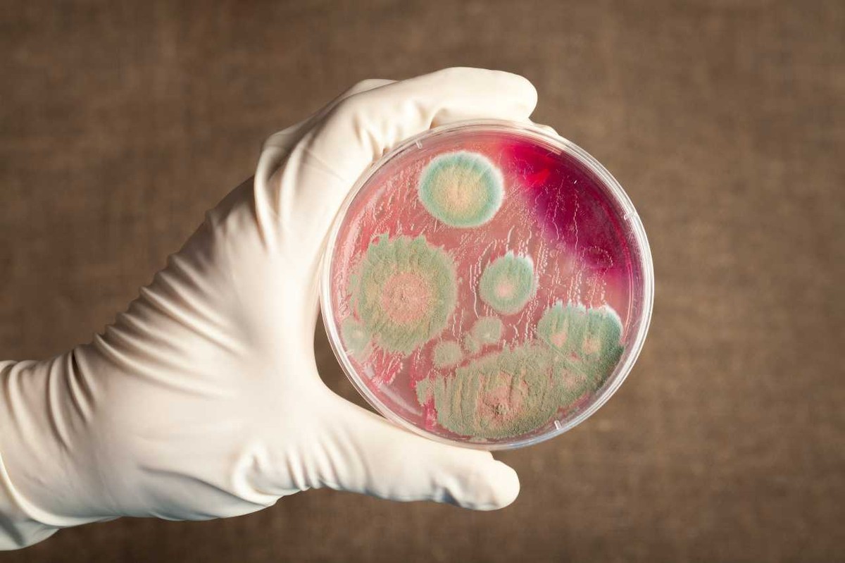 Epidemia wąglika w pięciu krajach. Światowa Organizacja Zdrowia ostrzega