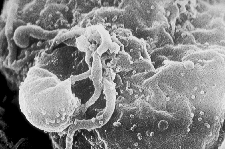 Wirus HIV Fot. C. Goldsmith/Public Domain
