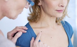 Jeden z najbardziej złośliwych nowotworów skóry: CZERNIAK. Jak zapobiegać?