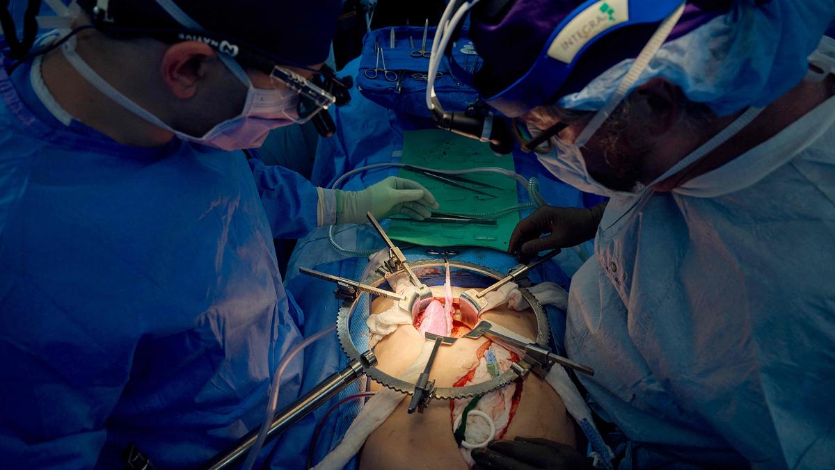 Chirurdzy z Massachusetts General Hospital w Bostonie przygotowują nerkę świni do przeszczepienia człowiekowi, 21 marca 2024 r