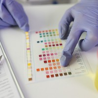 A hőség a veséket is ostromolja - ha ilyen színű a vizelete, már dehidratált, sürgősen igyon vizet!