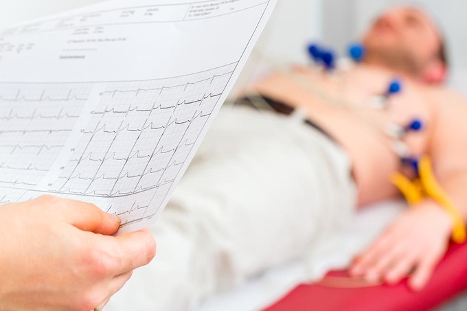 Szívritmuszavar: rossz szokások, amikkel növelhetjük az esélyét