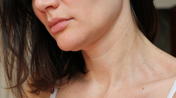 Naszyjnik Wenus to zmora kobiet. Mają go nawet trzydziestolatki