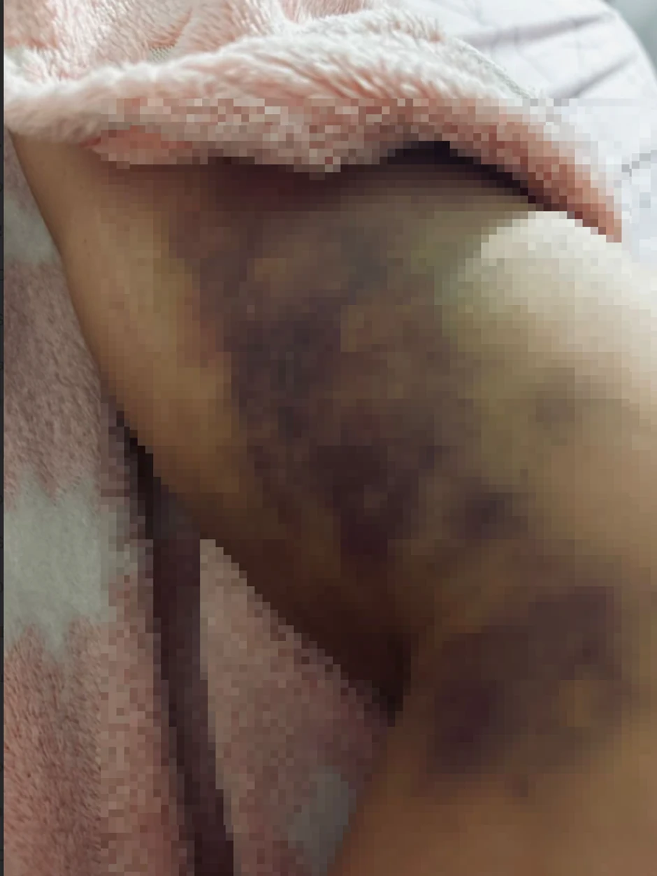 Aleksandrine modrice