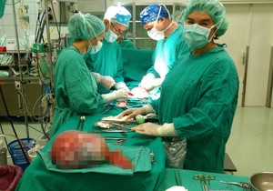 veliki tumor01 foto Facebook Poliklinika Eljuga