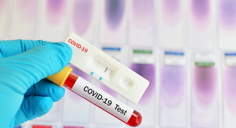 Coronavirus: 854 new cases take Ghana’s total to 22,822