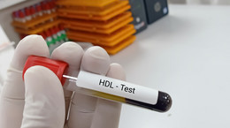 Co oznacza cholesterol HDL za niski? Ekspertka wyjaśnia