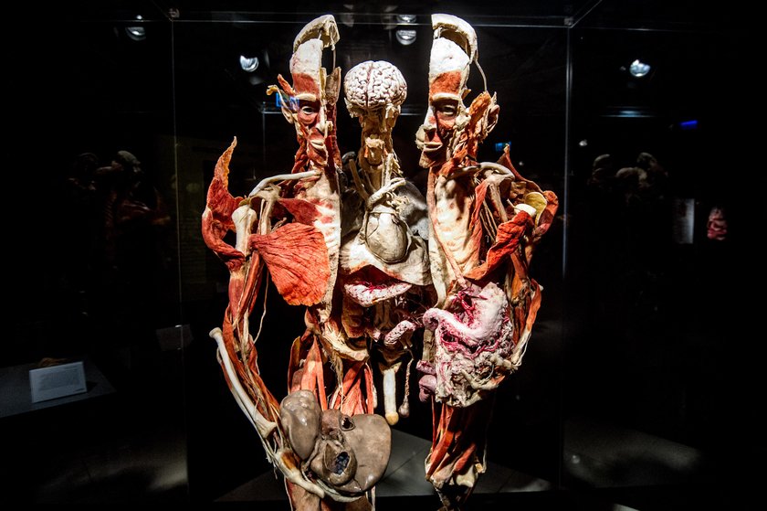 Wystawa Body Worlds w Krakowie 