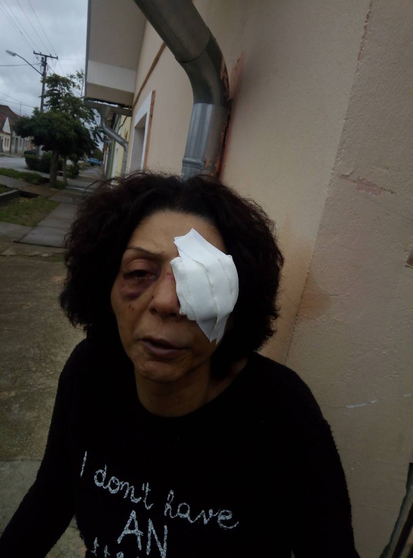 Dragica Jovanović se jedva otrgla iz ruku zločinca koji je pokušao da je siluje