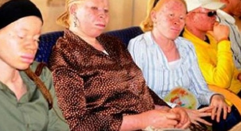 Members of the Albino Foundation of Nigeria