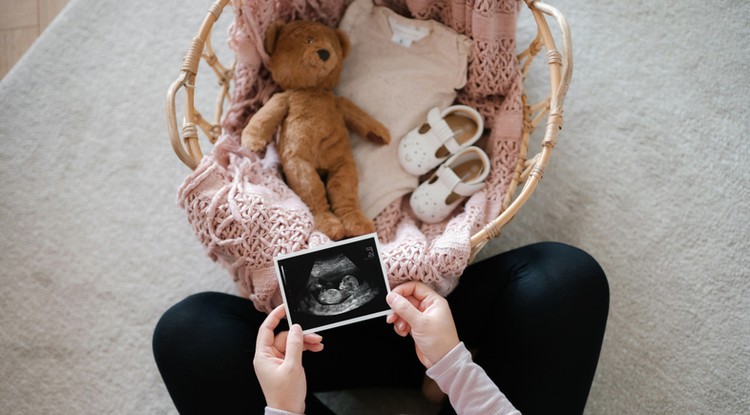 Ezt árulta el a babáról a Megasztár felfedezettje Fotó: Getty Images