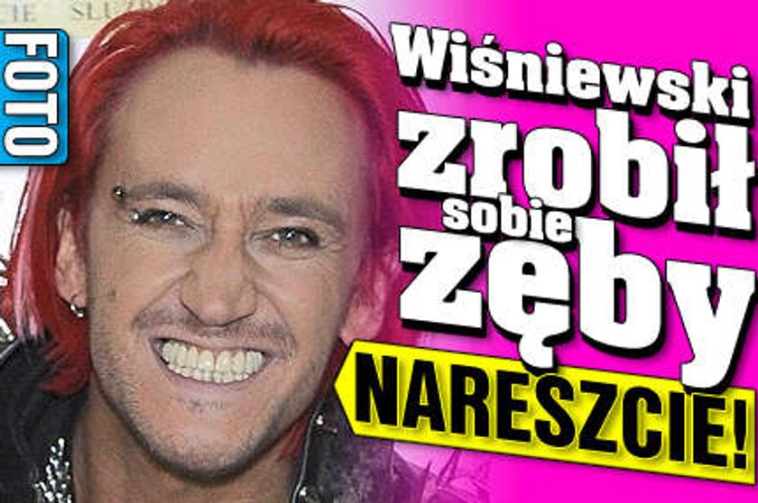 Wiśniewski zrobił sobie zęby. Nareszcie