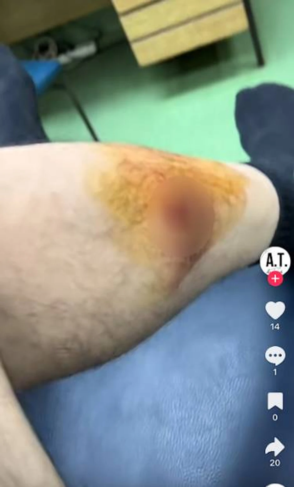 Upucan Andrija Terzić