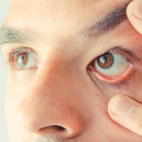 Retinoblastoma