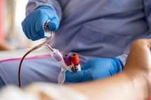 Badania krwi pozwolą wykryć raka pęcherzyka żółciowego. Co to za nowotwór?