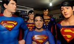 Chce wyglądać jak Superman. Miał 23 operacje