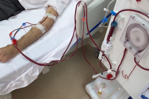 Hemodialysis Machine and Patient