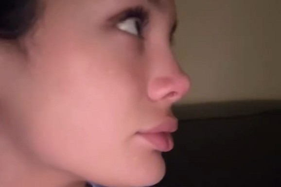 POKAZALA KAKO JOJ IZGLEDA NOS TRI MESECA NAKON OPERACIJE "Svakim danom je lepši", sestra Lune Đogani ga snima iz svih uglova (VIDEO)