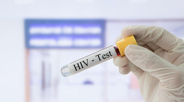 HIV ciągle realnym zagrożeniem w Polsce