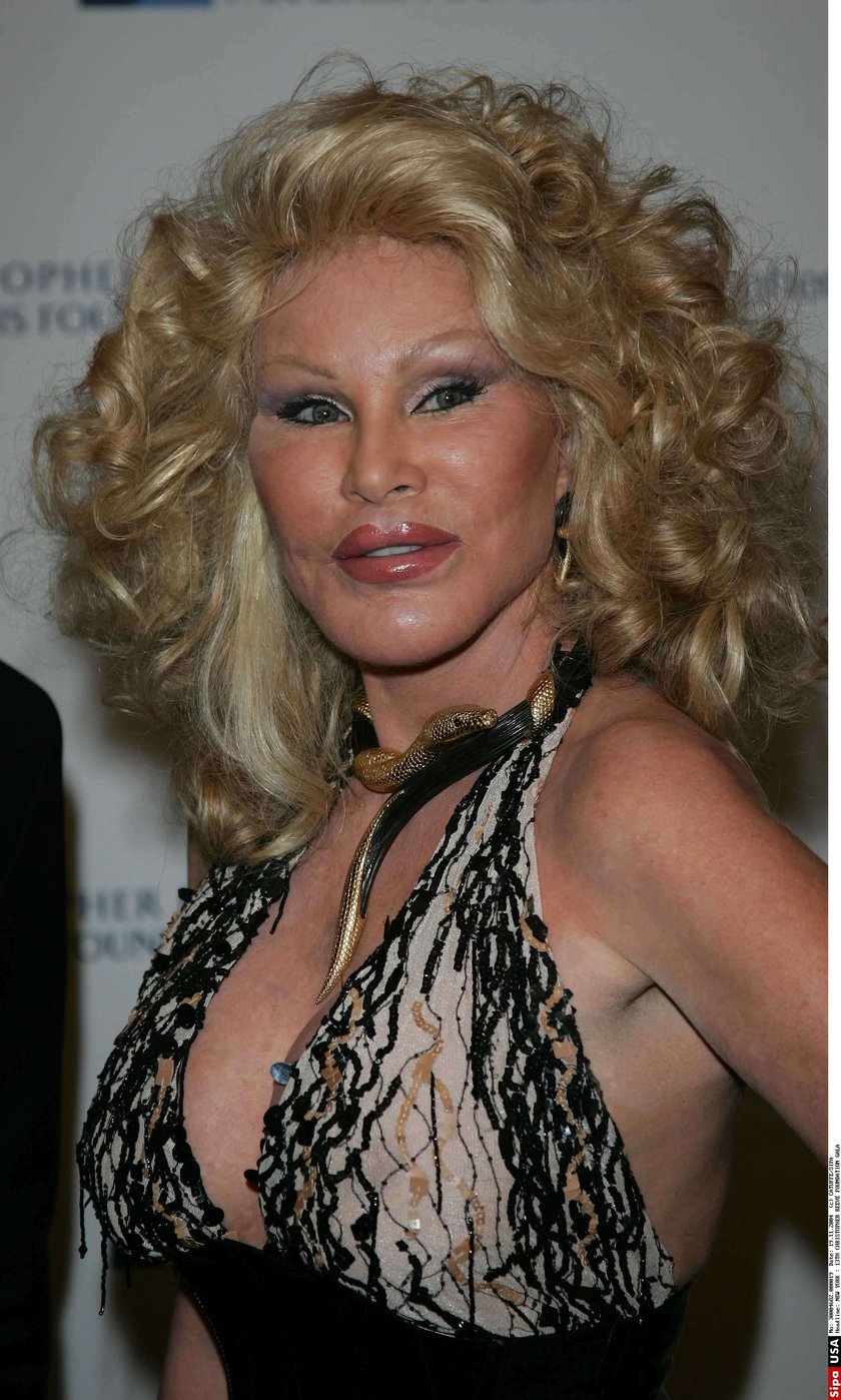 Jocelyn Wildenstein