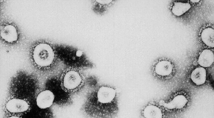 Koronavírus mikroszkó alatt forrás: Getty Images
